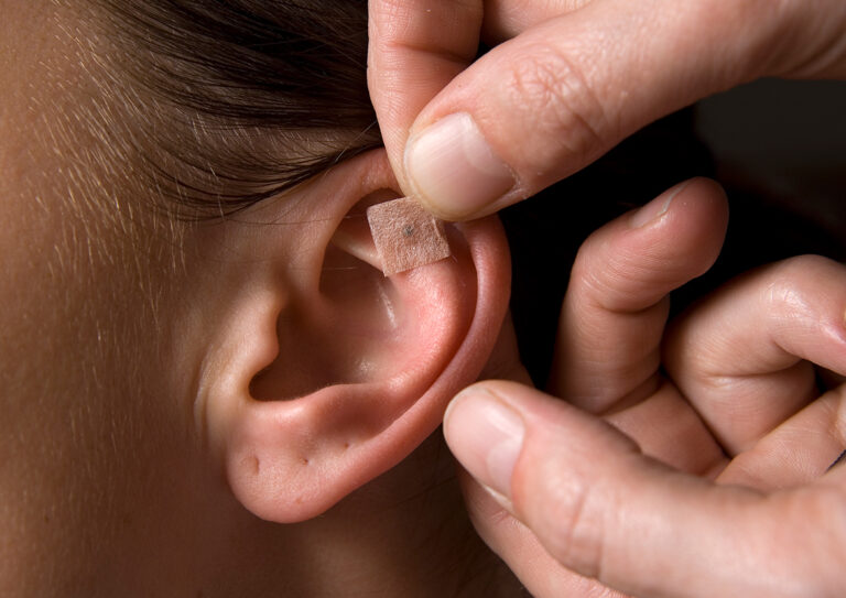 Curso Auriculoterapia